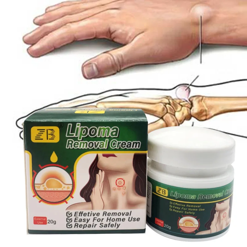 ZB 20g Pure Natural Chinese Herbal Lipoma Removal Cream Efficiently Removes Lipoma Fibroids Subcutaneous Lumps Body Health Care