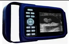 

portable ultrasound scanner price veterinario portatil ecografo ultrasonido machine