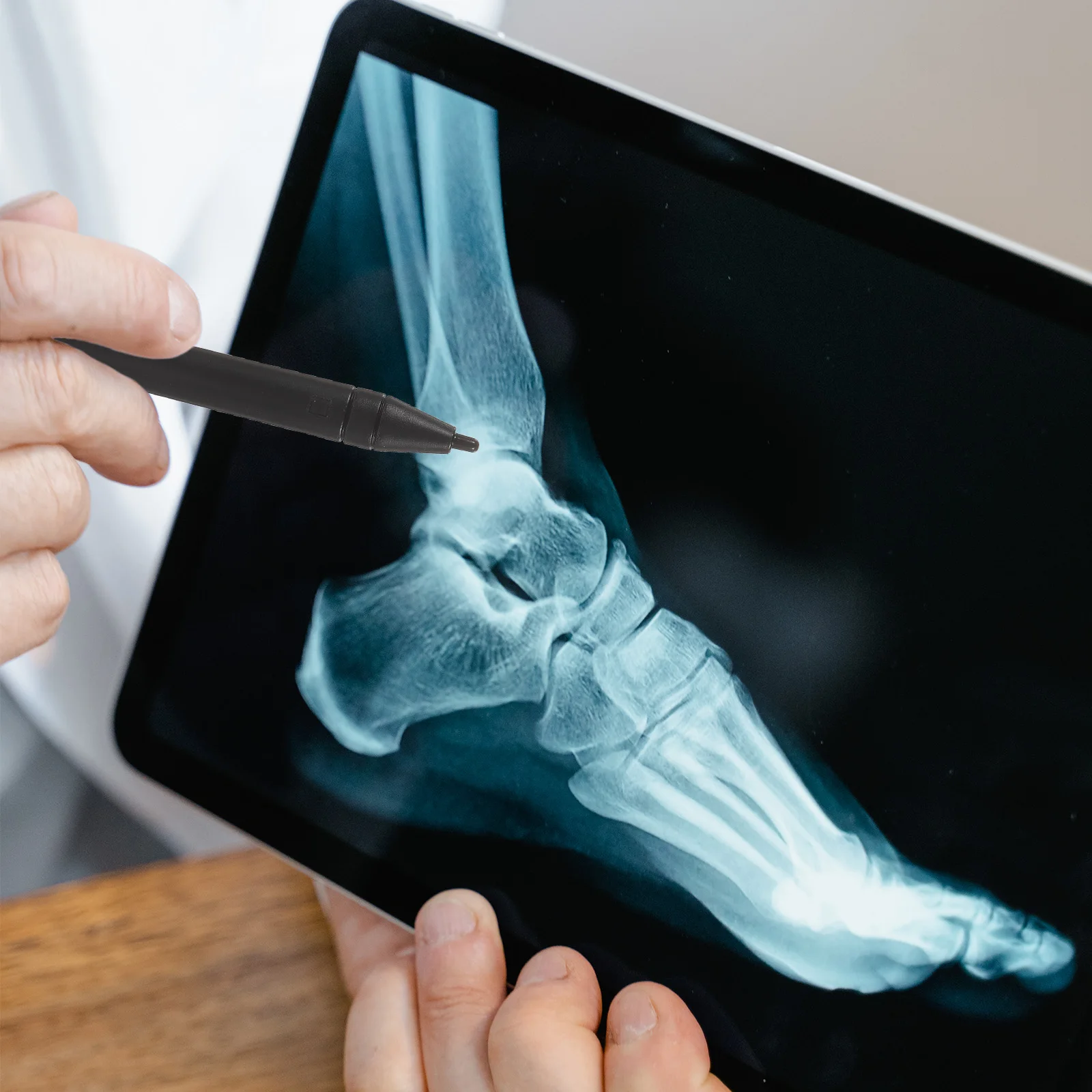 

2 шт., ручка для планшета для рукописного ввода, высокоточный стилус для художников, студентов, учителей, офисных работников, планшеты для рисования, креативная ручка