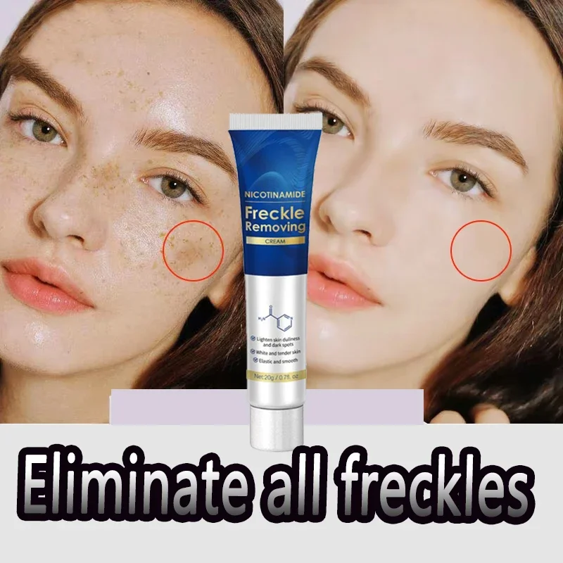 Freckle Removing Cream Blemish Reduces Chloasma Age Spots Dark Spot Sun Spots Lightening Face Cream Korean Skin Care