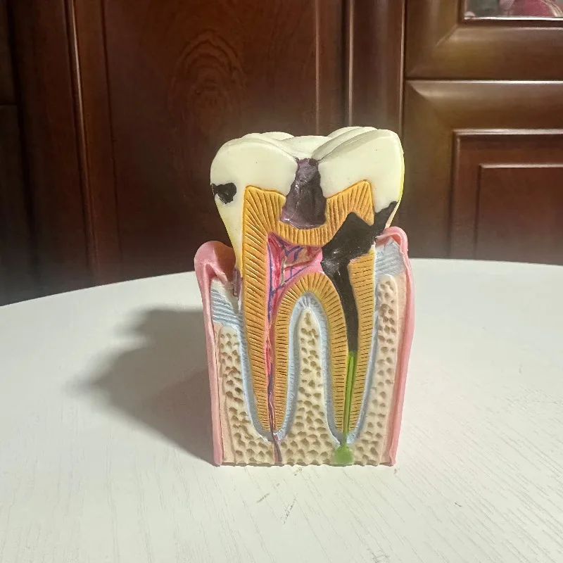 The Anatomical Education Model of Dental Caries 6 Bilateral Cross-sectional Presentation of Medical Research