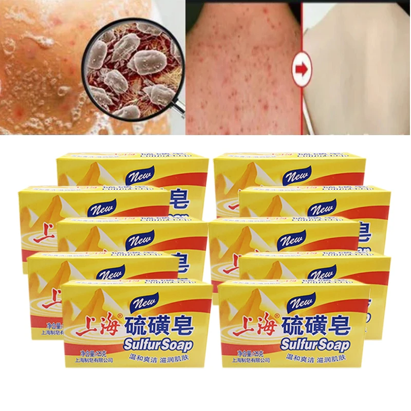 10PCS Shanghai Sulfur Soap Bath Soap Clean Wash Hands And Face Clean Unisex Soap Behind The Skin Face deep clean