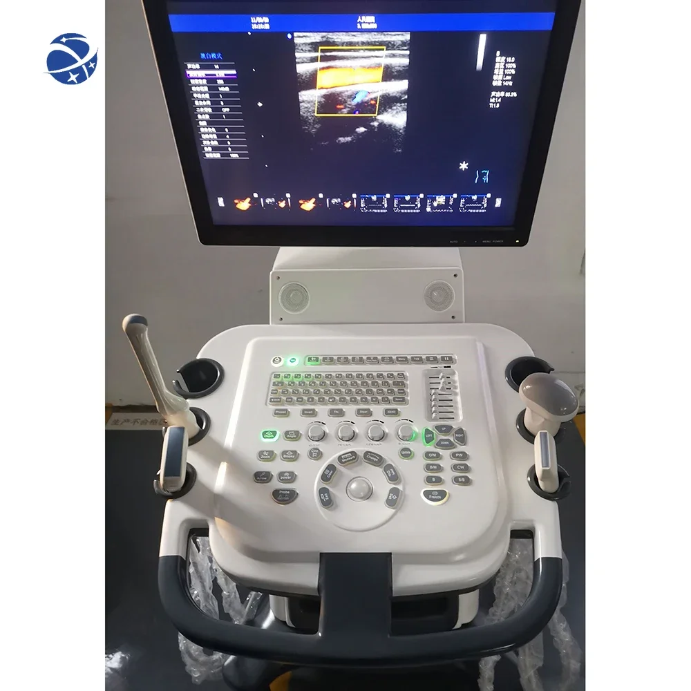 Medical Ultrasonography Ultrasound Machine Trolley Color Doppler Echocardiography Machine Ultrasound Used 4d Ultrasound Machine