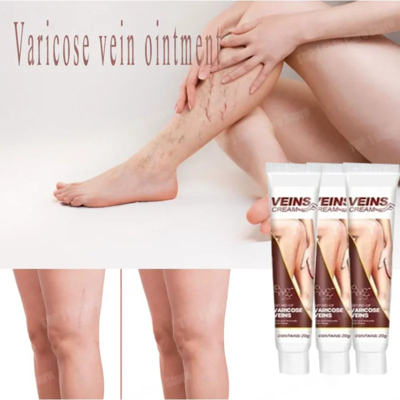 Safe and effective varicose vein removal Effective treatment of vasculitis Fast treatment of leg varicose vein removal  Fast