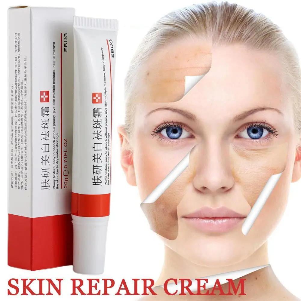 Effective Whitening Acne Treatment Cream Fade Dark Spots Oil Control Pores Shrink Removal Scar Anti Pimples Moisturizing Cream