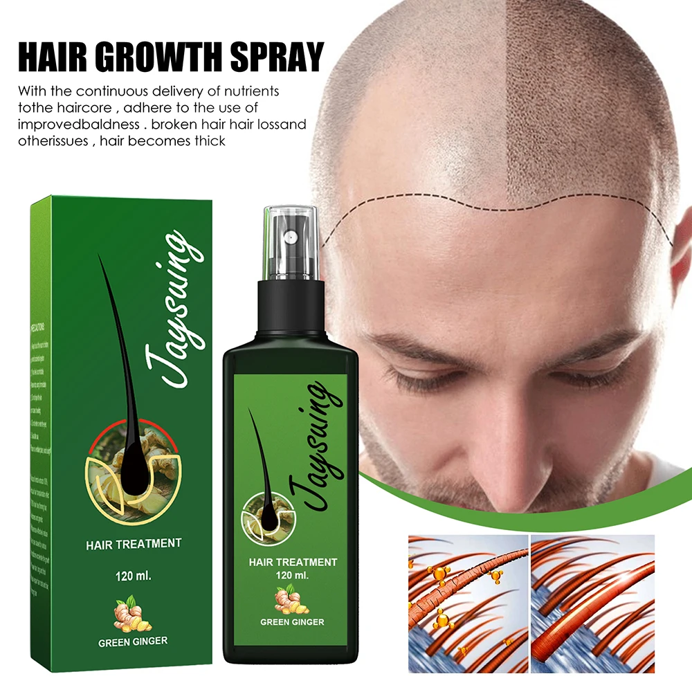 Fast Ginger Hair Growth Spray Roots Grow Anti Hair Loss Serum Liquid Scalp Damaged Treatment Repair Care Products Beauty Health