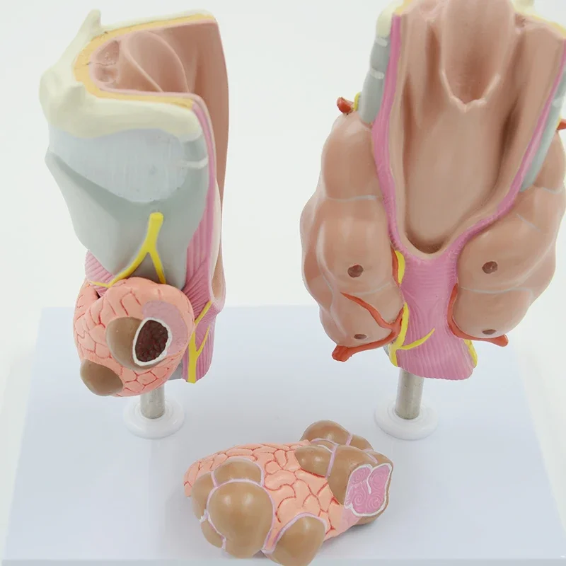 Throat Thyroid Model Detachable Pathology Throat Anatomy Model , Endocrine System Education Model