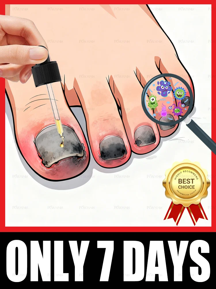 Bᴏᴛᴀɴɪᴄᴀʟ-Bᴏᴏsᴛᴇᴅ Fᴏʀᴍᴜʟᴀ ᴛᴏ Wɪᴘᴇ Oᴜᴛ Fᴜɴɢɪ & Rᴇɪɴᴠɪɢᴏʀᴀᴛᴇ Hᴇᴀʟᴛʜʏ Nᴀɪʟ Gʀᴏᴡᴛʜ, Fɪᴛs ғᴏʀ Hᴀɴᴅs ᴀɴᴅ Fᴇᴇᴛ, Tʀᴇɴᴅɪɴɢ ɪɴ 2025 #1