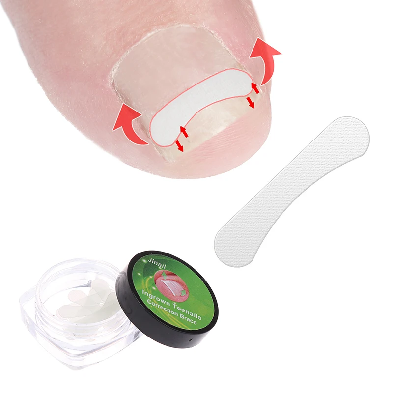 10Pcs Toe Nail Treatment Elastic Patch Sticker Pedicure Tool Ingrown Toenail Correction Tool Straightening Clip Brace Ingrown