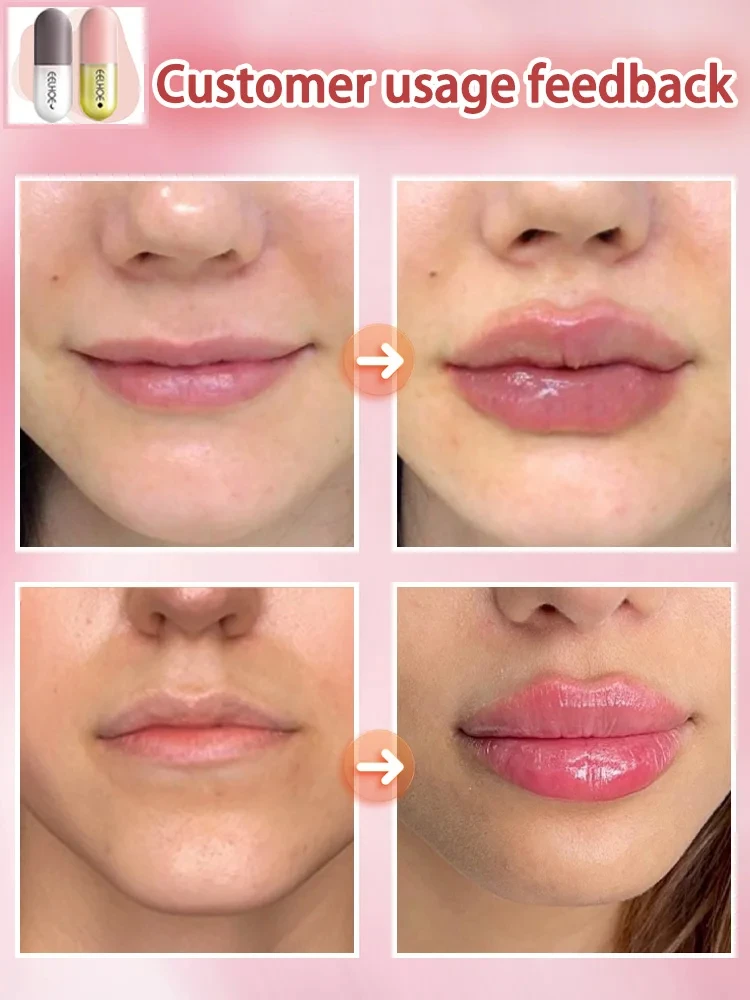 Lippen Plumping Gloss Lip Mollige Serum Verhogen Instant Volume