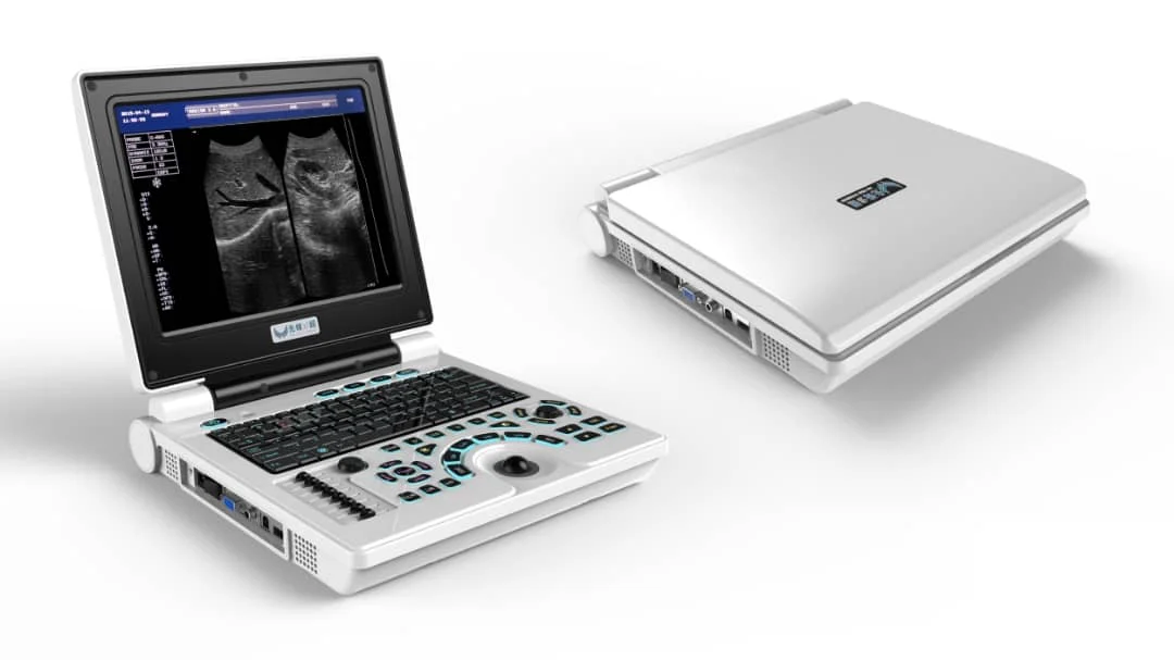 Cheapest and affordable Full Digital Black and White Notebook/Laptop 12 inches Veterinary Ultrasound Scanner factory price