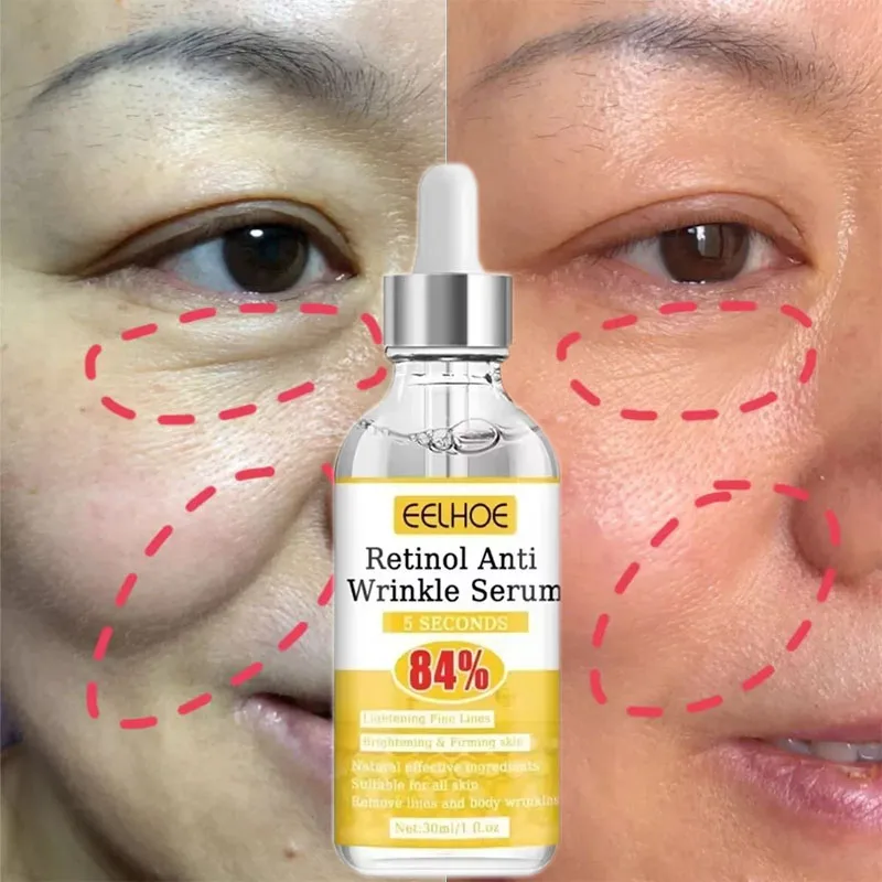 Retinol Wrinkle Remover Face Serum Hyaluronic Acid Anti-Aging Lifting Firming Fade Fine Lines Anti-Puffiness Skin Care Essence