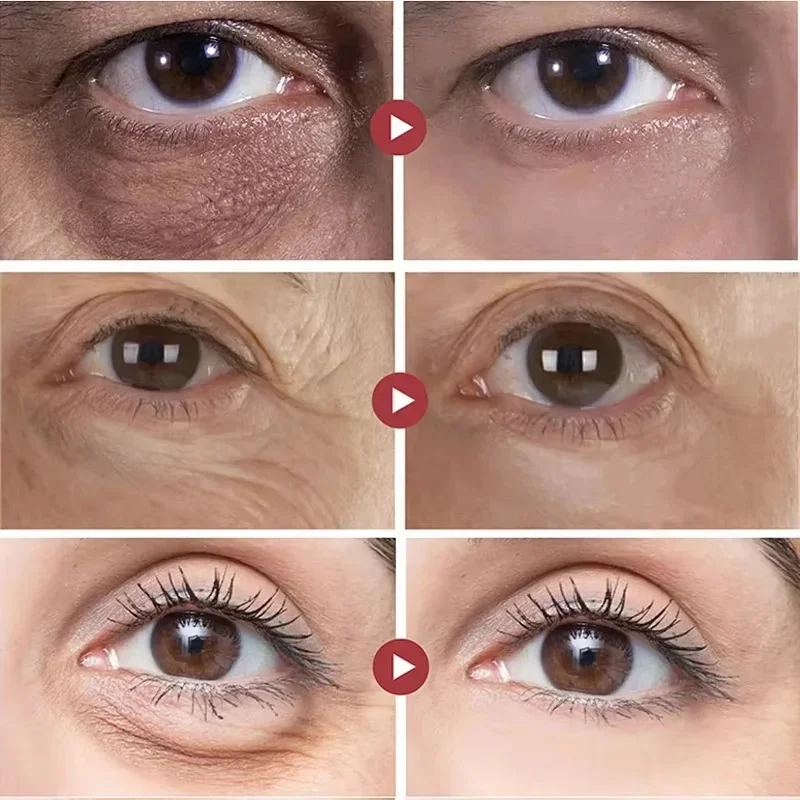 كريم عين الريتينول المضاد للتجاعيد إزالة أكياس العين الهالات السوداء مكافحة الشيخوخة رفع ترطيب اشراق كفاف العين العناية بالجمال