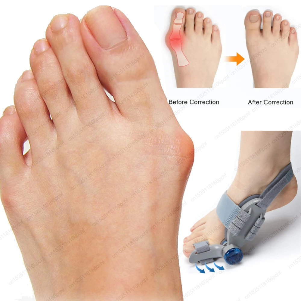 Hallux Valgus Correction foot corrector Bunion Splint Big Toe Straightener Orthopedic Corrector Pedicure Bunion Protector Toes