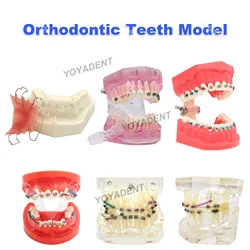 Dental Orthodontic Teeth Model With Hawley Retainer Metal/ Ceramic Brackets Teaching Models For Dentist Patient Communication