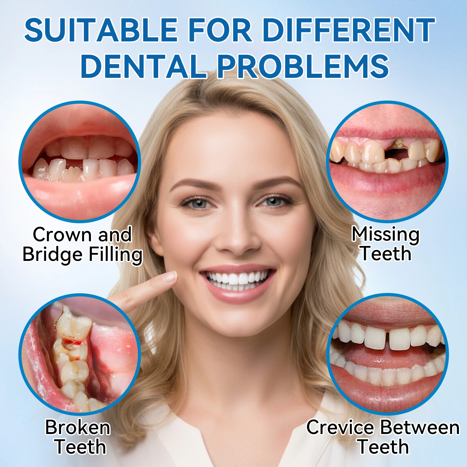 Instant Temporary Fake Teeth – Cosmetic Replacement Aid for Missing & Broken Teeth – Quick to Use, Non-Toxic & Biodegradable