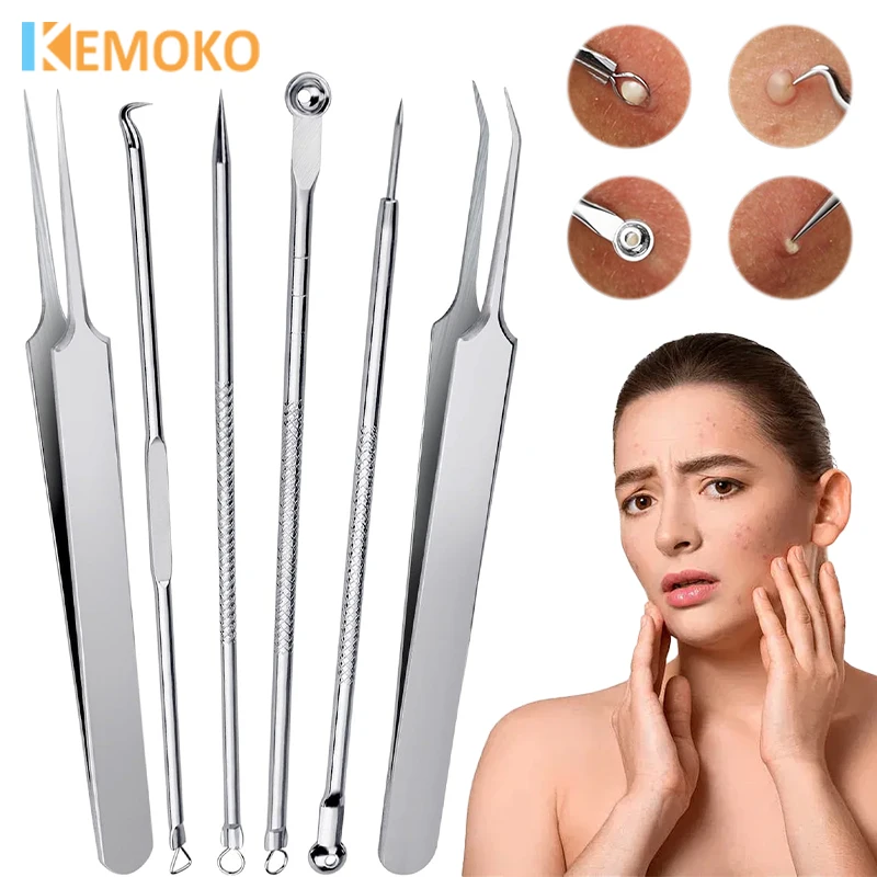 4-11 Pz Clip per punti neri Brufoli Pinzetta Rimozione di punti neri Clip per celle Prodotto di bellezza Acne Ago Pulizia della pelle in acciaio inossidabile