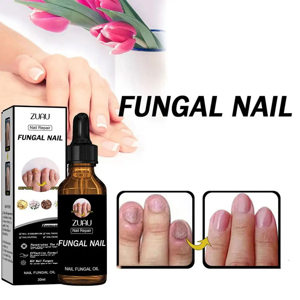 30ml Nail Repair Solution Thickening Brightening Nails Nail Nourishing Nail Moisturizing Gray Nail And Repair Removing Solu O6V1