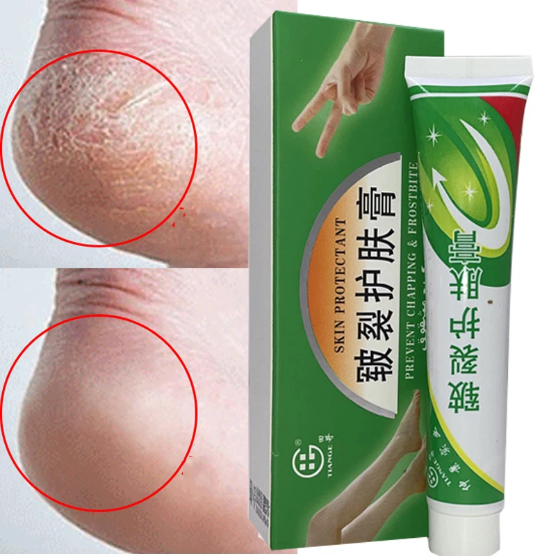 Chinese Herbal 25g Oil Anti-Drying Crack Foot Cream Heel Cracked Repair Cream Removal Dead Skin Hand Feet Care Foot Mask