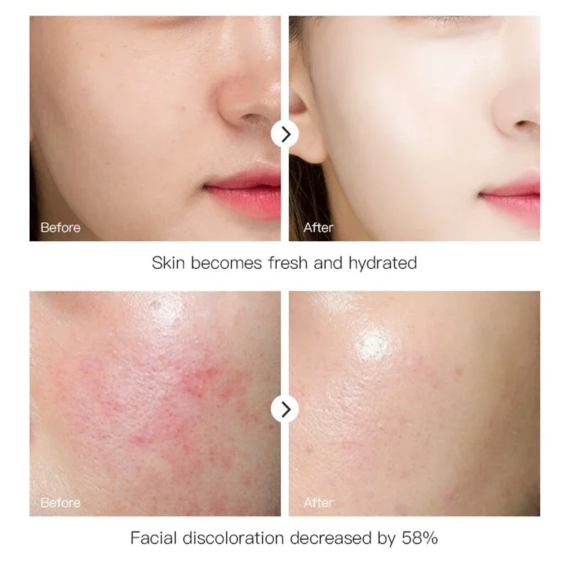 Hyaluronic Acid Six Peptides Facial Serum 30ml Anti-wrinkle Anti-aging Dark Circle Face Essence Moisturizing Brightening Skin