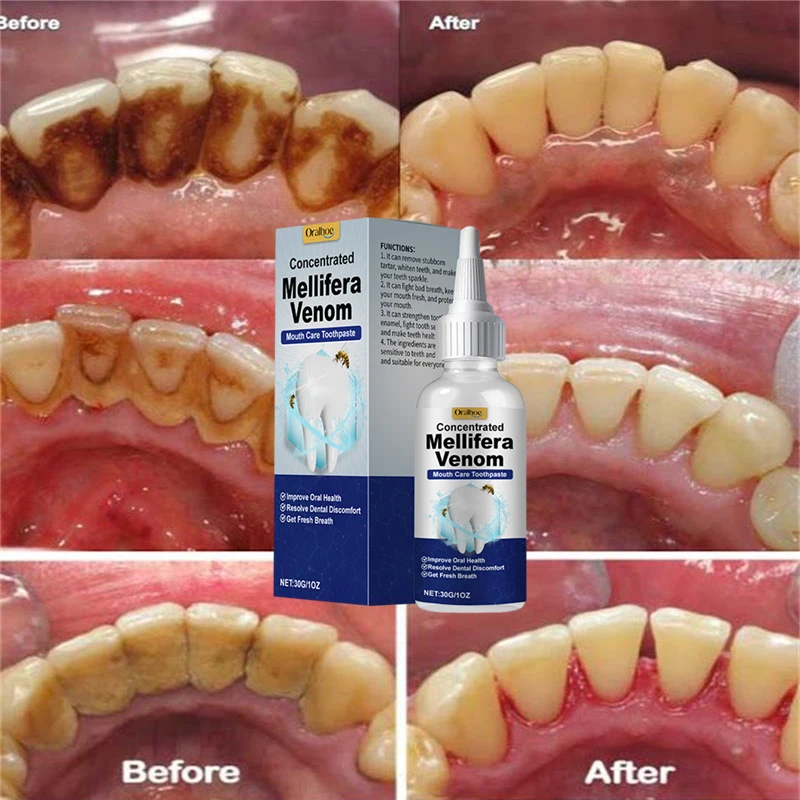 Pulizia dei denti Siero sbiancante Rimuovi placca Denti bianchi Gel Denti Macchie di fumo giallo Dentifricio Alito fresco Cura dell'igiene orale