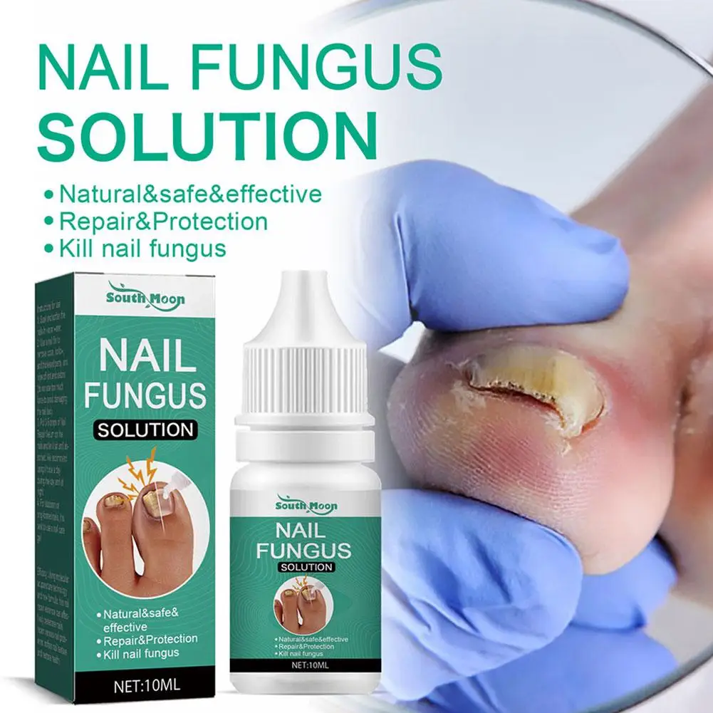 Strong Nail Fungus Treatment Serum Essence Feet Removal Care Toe Serum Infection Anti Cream Repa Essence Nails Fungal W7j4