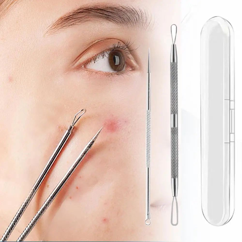 Pince à pression d'acné en acier inoxydable, dissolvant de graisse en acier pour points noirs, outil de compression d'acné, outils pour points noirs J4X8