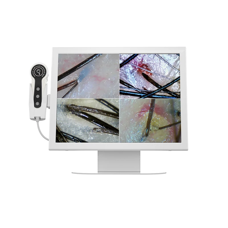 トリコスキャン毛髪・頭皮分析 頭皮脱毛症検出器 高解像度画像毛髪分析器