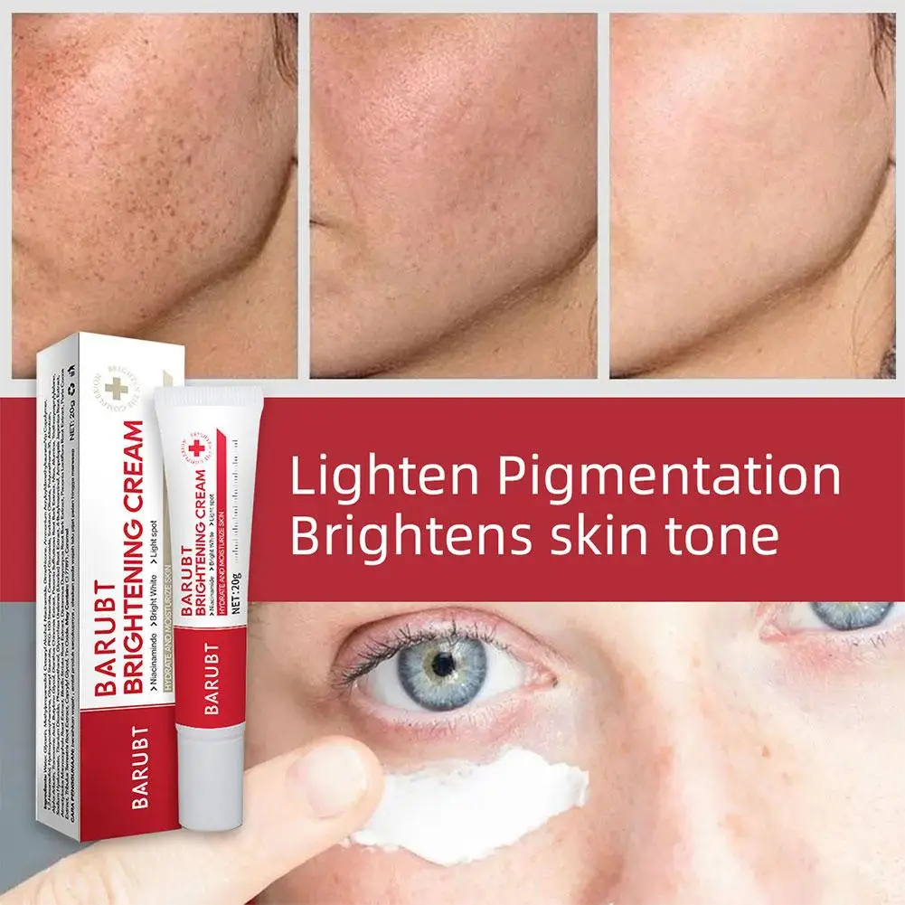 Whitening Freckle Cream Remove Melasma Cream Remove Dark Spots Melasma Remover Brighten Skin Anti-Aging Skin Lightening