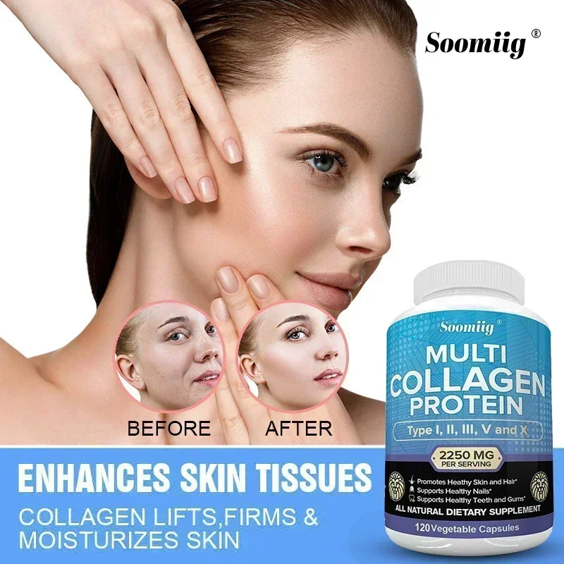 Super Collagen Peptides, Multi-Collagen Protein, Gluten Free, Non-GMO, Grass Fed, Good for Hair Skin Nails Teeth Gums Joints