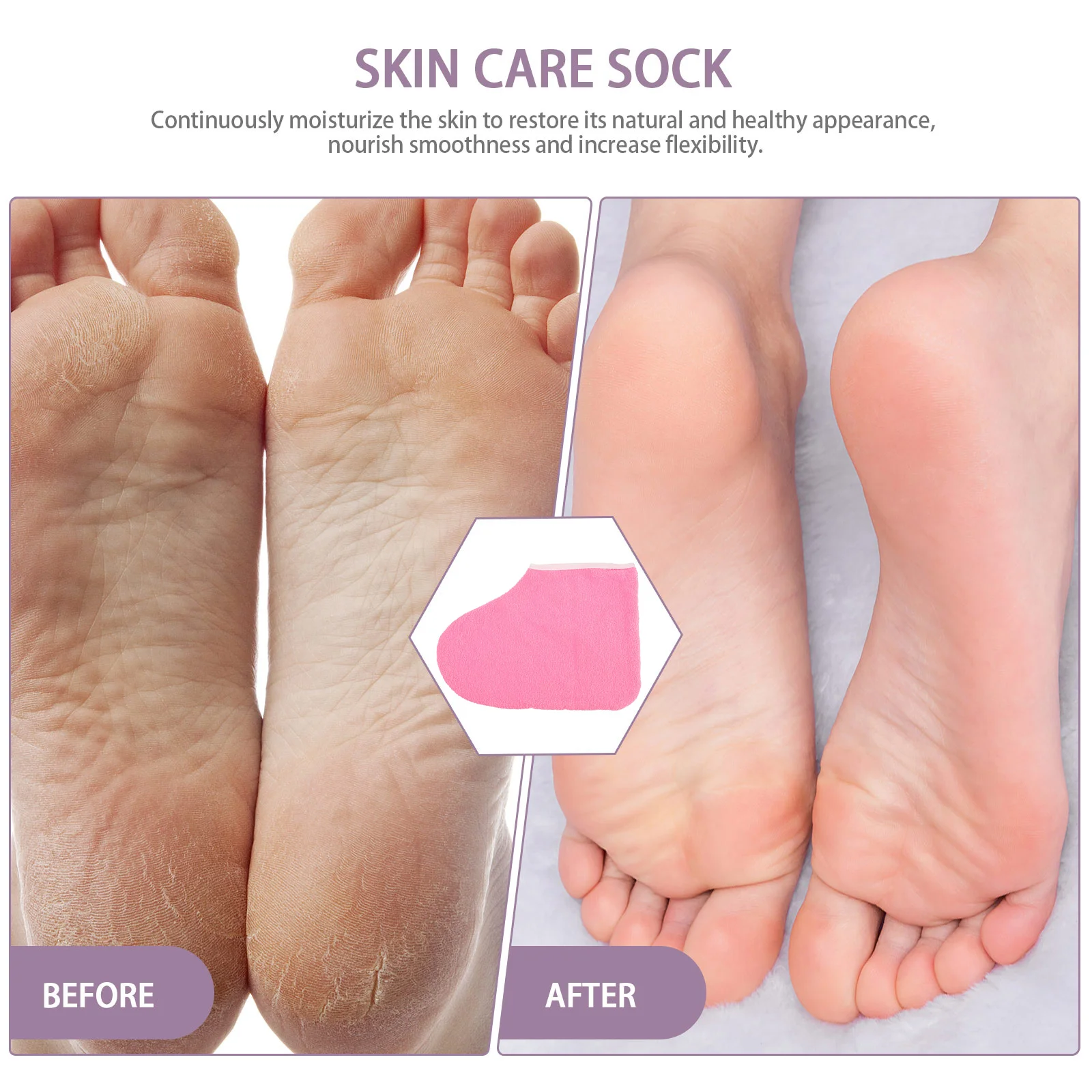 2 قطعة الجوارب مانيكير كعب مضخات للنساء سبا ترطيب إصلاح الجوارب المرأة الكعب المتسكعون #3