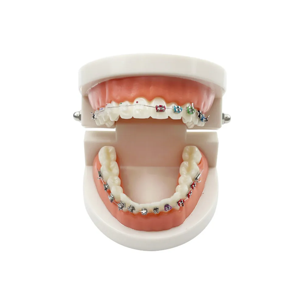 Model ortodontyczny z samodzielnym wspornikiem metalowym Aparat ceramiczny Typodont Stomatologia Zęby Nauczanie Studium Produkty demonstracyjne