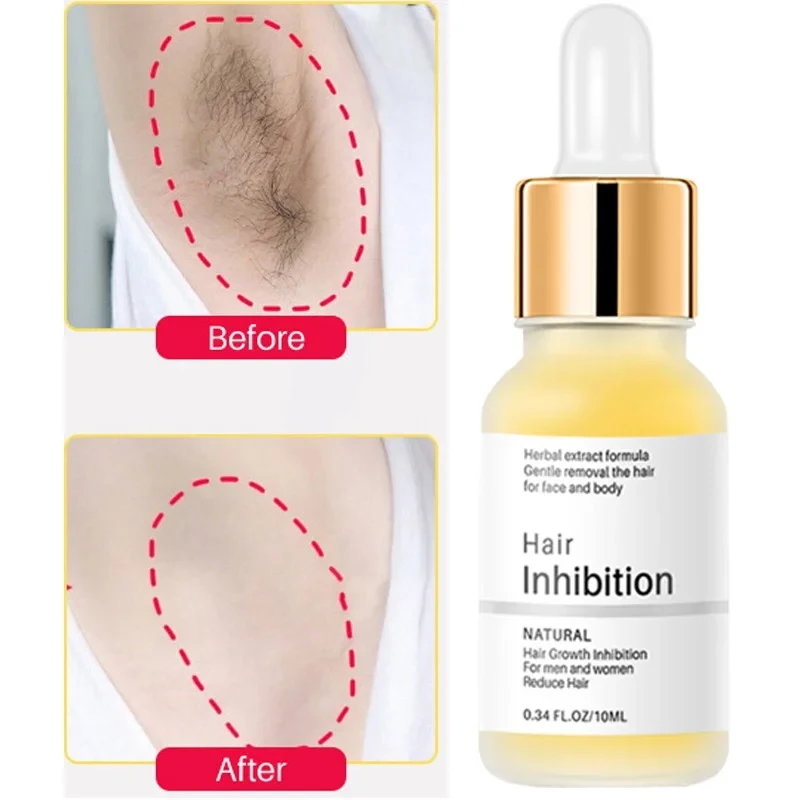 Hair Growth Inhibitor Hair Remover Women Men Facial Hair Remover Intimate Hair Removal Cream Body Hair Removal Eraser Spray 10ML