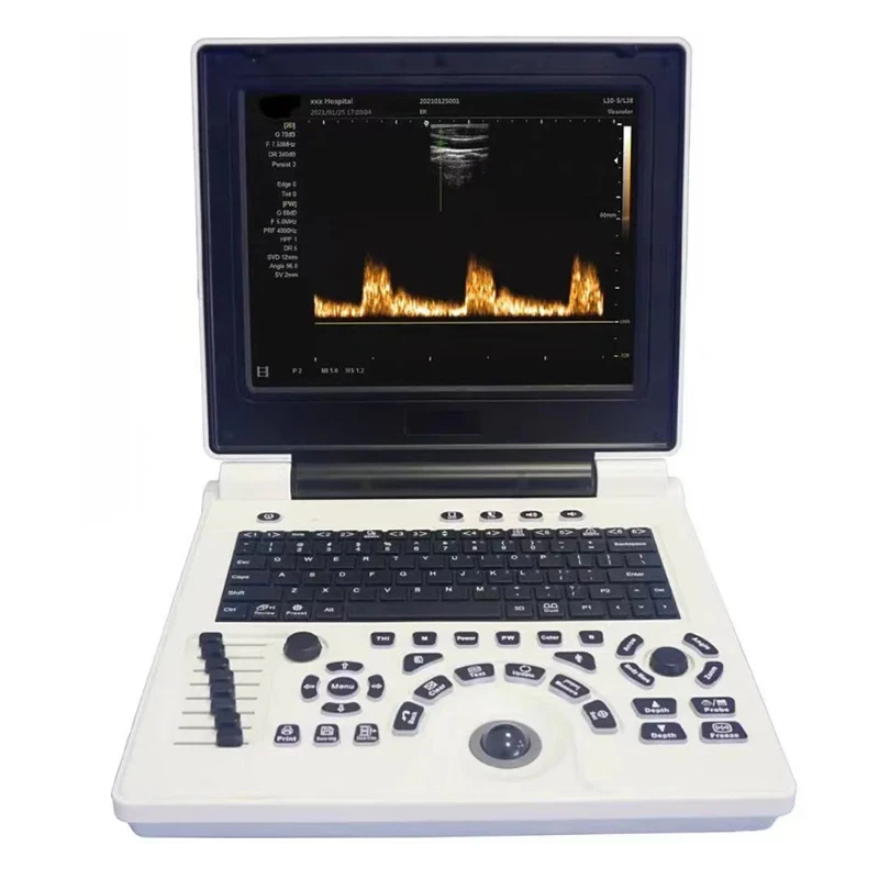 Ultrasonograf maszyna weterynaryjna Laptop 12 Cal przenośne czarne białe dopplerowskie zwierzęta gospodarskie ciąży wypukłe sondy, z USB