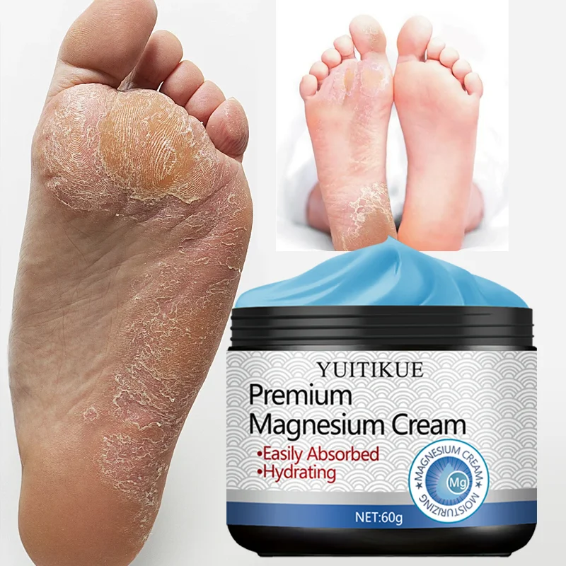 YUITIKUE 60g Premium Magnesium Cream Fast Absorbing Non-Greasy Moisturizing & Softening for Hand And Foot Care