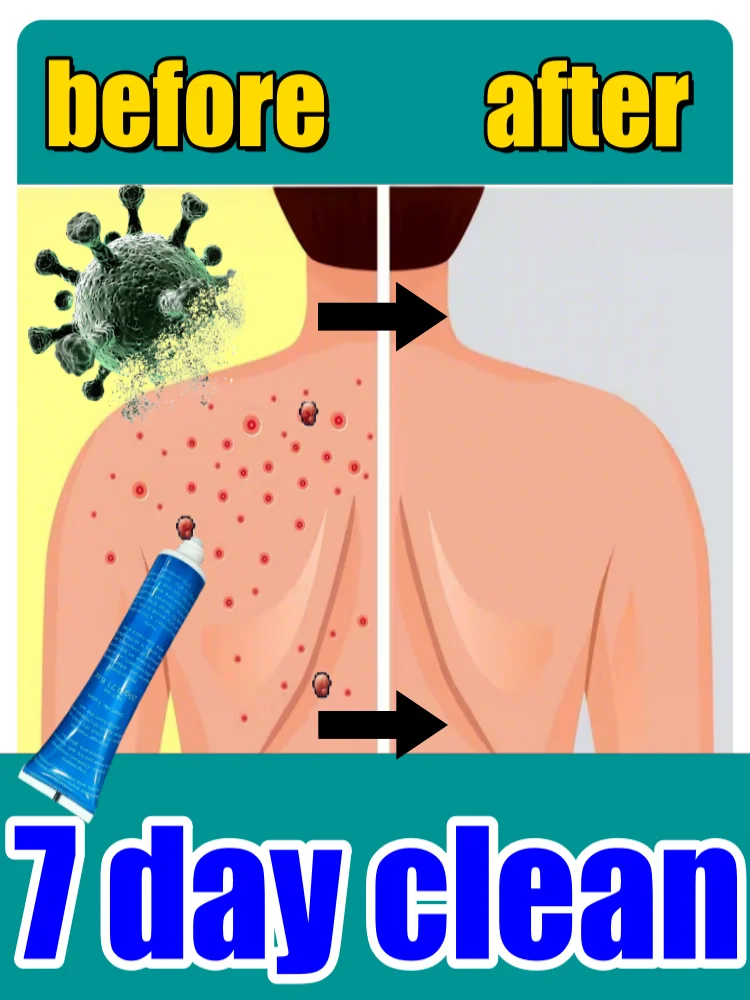 

2025 skincare tools: Say goodbye to skin vegetations