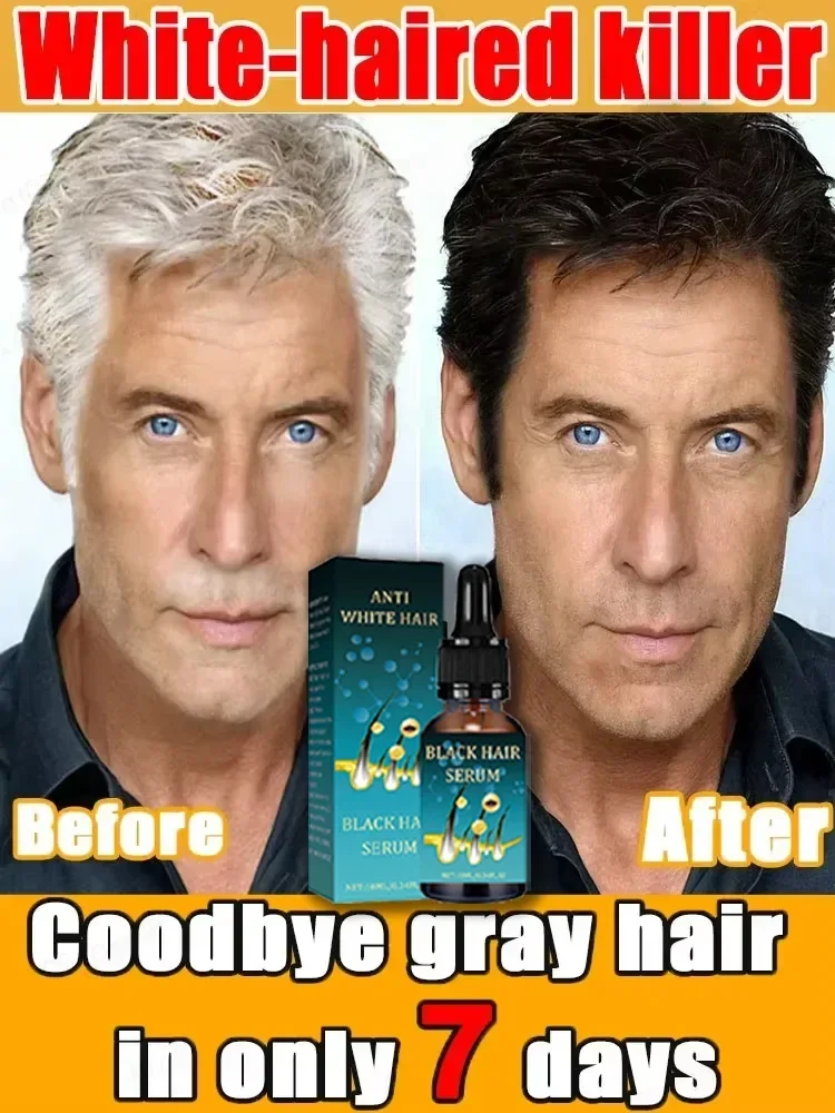 Anti-grey hair essence Serum treatment restore naturalcolor and restore healthy White To Black hair products essence