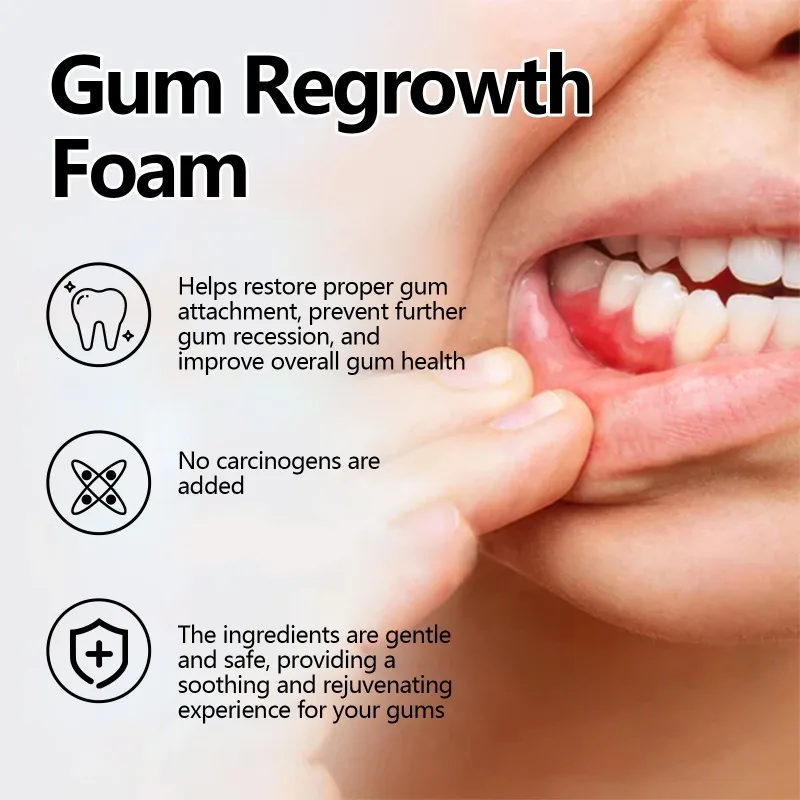 Espuma para recrescimento de goma, clareamento dos dentes amarelos, pasta de dente, limpeza eficaz, remoção de manchas dentárias, produto de limpeza oral