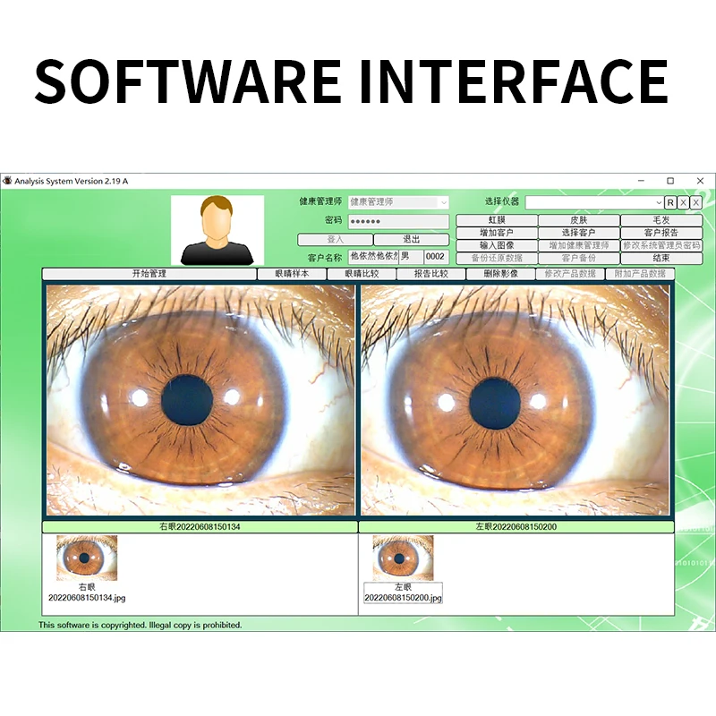 Cámara ocular multifunción profesional de 12 MP, escáner de iridología, Detector de Iris Digital