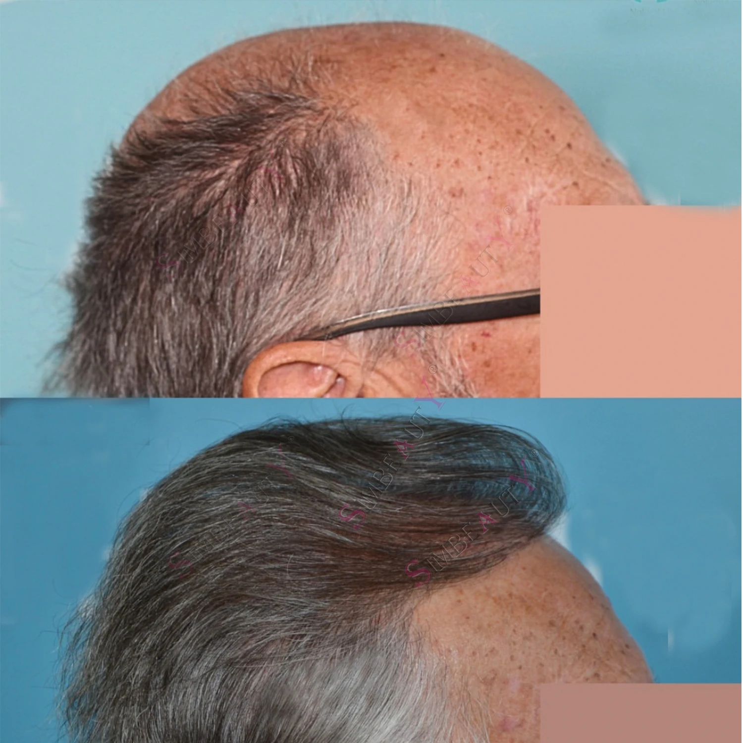 80% رقيقة جدا 0.02 مللي متر خط شعري غير مرئي 1B20 رمادي الرجال الشعر المستعار بني أشقر HD بولي سيليكون شفاف بولي شعر بشري طبيعي احتيافي #1