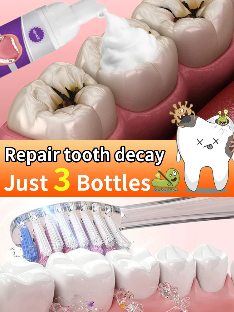 

tooh Decay repair