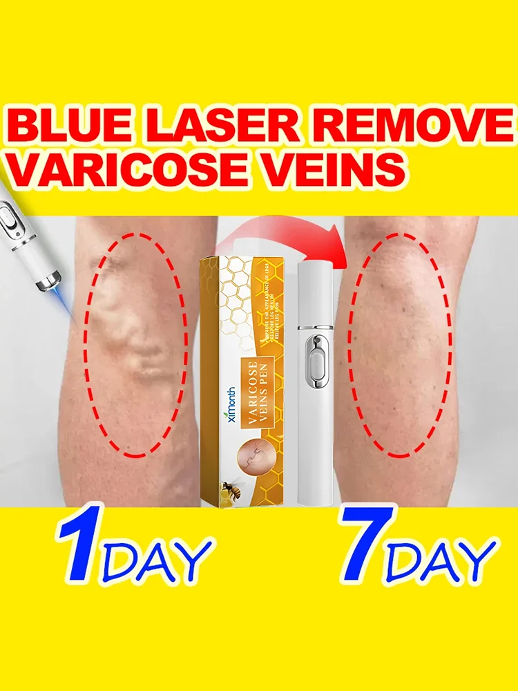 Hot sale Nano Laser Leg care