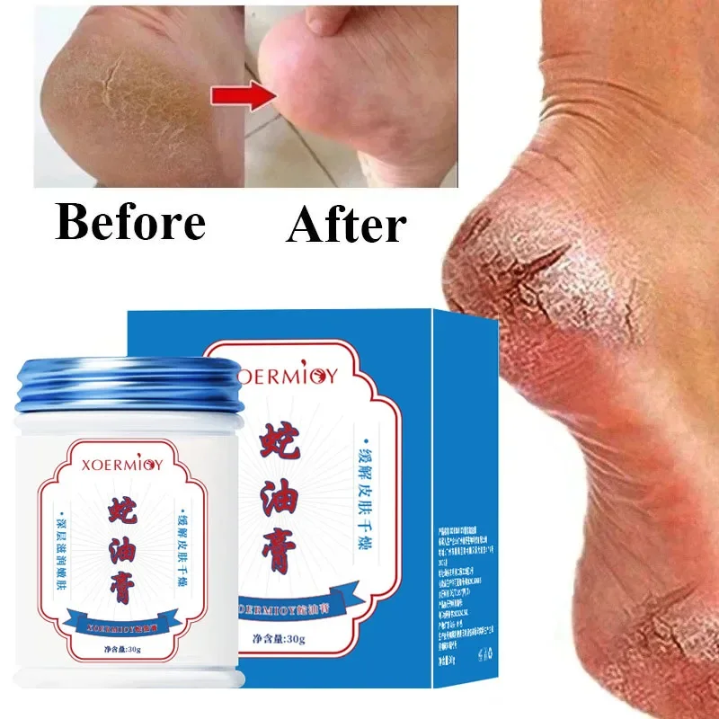 Herbal Anti Crack Foot Cream Heel Cracking Repair Products Exfoliation Dead Skin Removal Softening Moisturize Smooth Skin Care