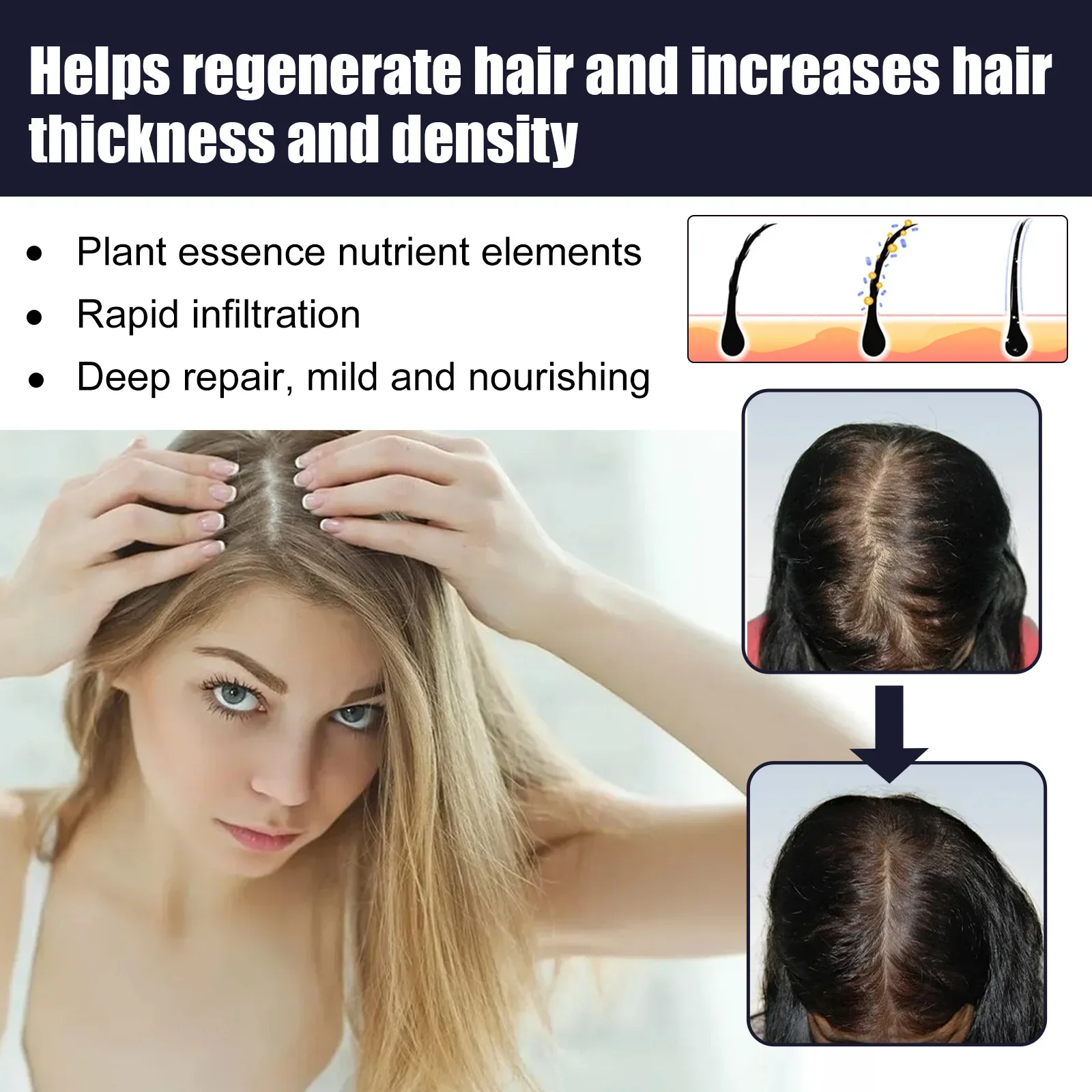 Sdatter Ginger Hair Growth Essential Oil For Rapid Growth Of Hair Anti-Alopecia Scalp Treatment Product Dry Curl Anti-Baldness S