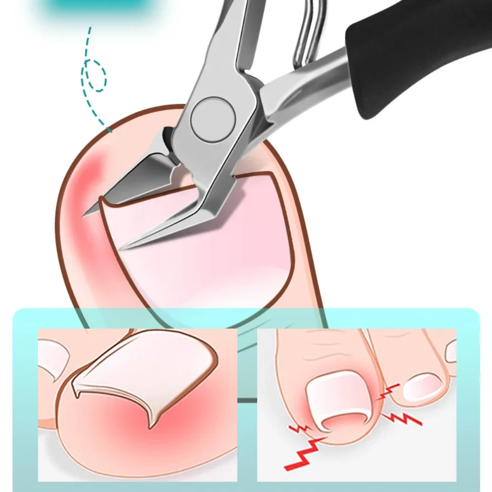 

1Pc Sharp Toenail Nail Clippers & Trimmers Edge Cutter Nail Pliers Trimmers Dead Skin Remover Pedicure Manicure Tools