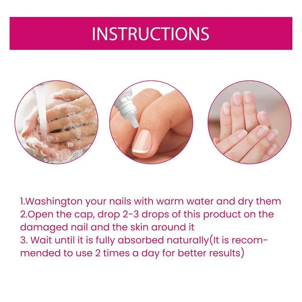 Ekstra Silne Serum na Grzybicę Paznokci Olejek Esencja Krem na Infekcje Palców Naprawczy Esencja Żel Przeciwgrzybiczy do Usuwania Pielęgnacja Stóp