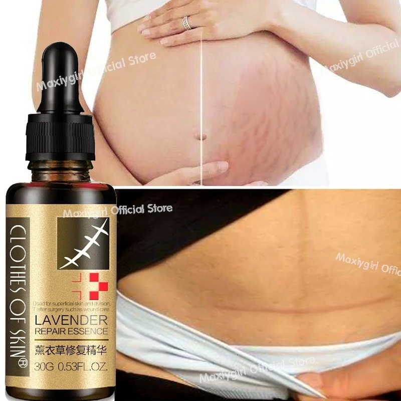 

Натуральное чистое восстанавливающее эфирное масло для ухода за кожей лаванды 30 г