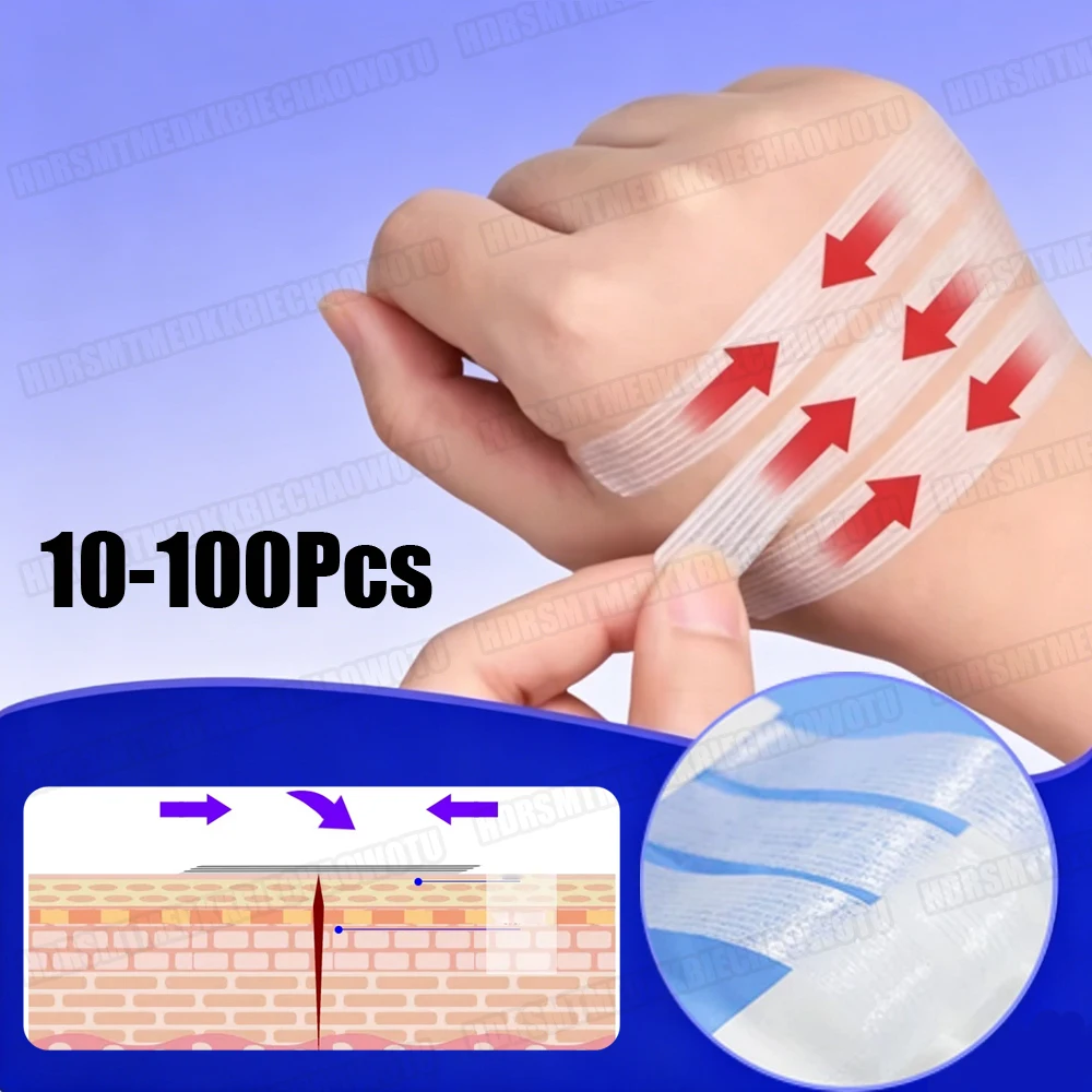 

10-100Pcs Wound Skin Closure Strips Postpartum Wound Repair Cosmetic Surgery Seam-Free Adhesive Stripe Tape Protector Sticker