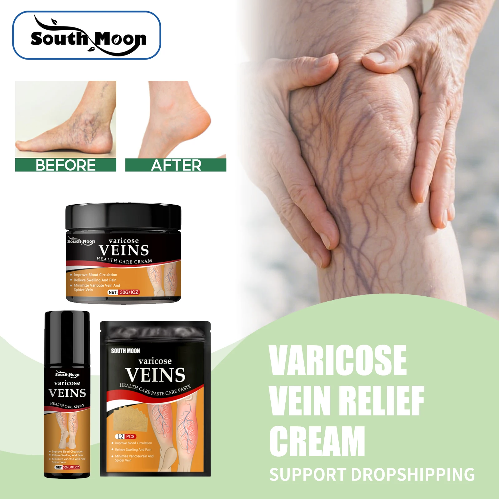 Varicose Vein Treatment Cream Unclog Blood Vessels Prevent Blockage Enhance Vessel Wall Smooth Leg Spider Veins Removal Patch