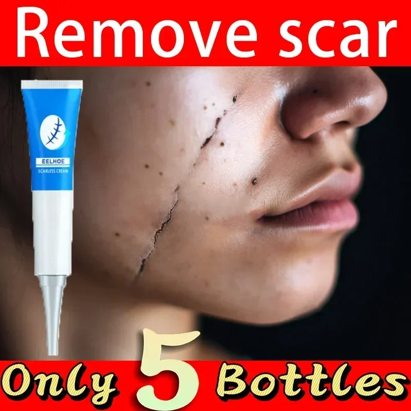 HOT SALE Women's Beauty And Scar Removal Keeps The Face Moisturized And Repairs Damaged Skin Scar Postoperative scar repair